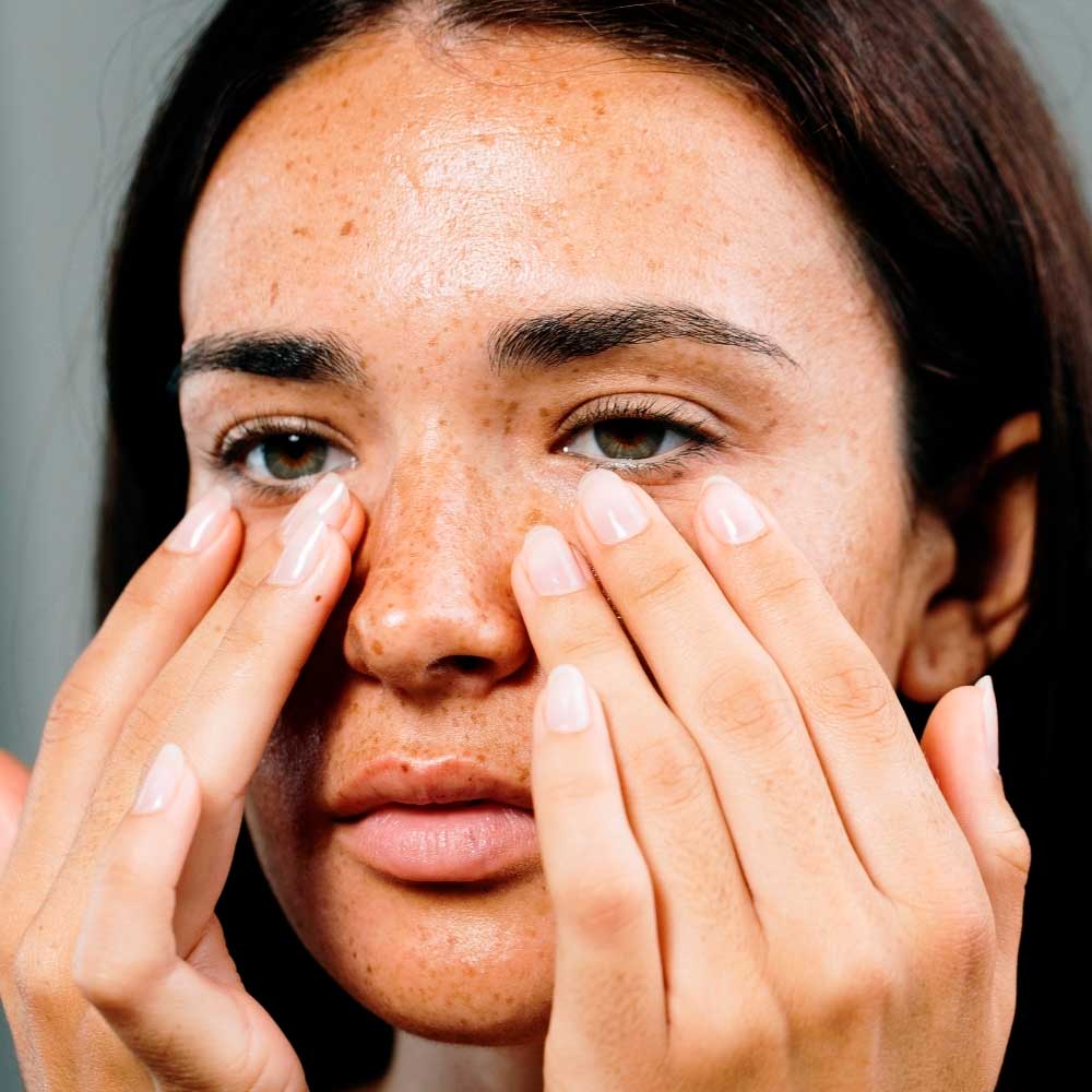 Cómo mejorar la piel de los ojos con cuidados y remedios naturales