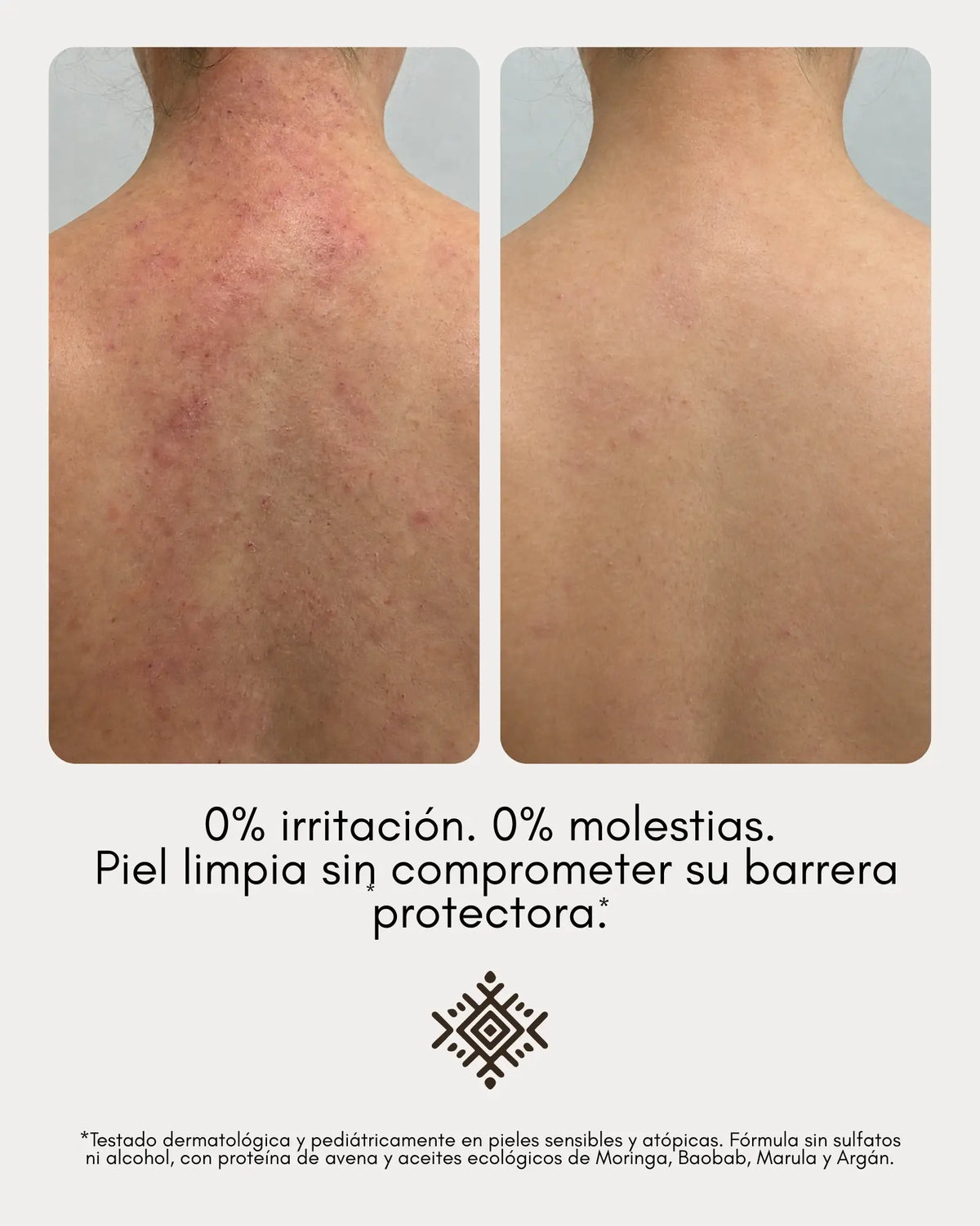 Limpiador Piel Atópica