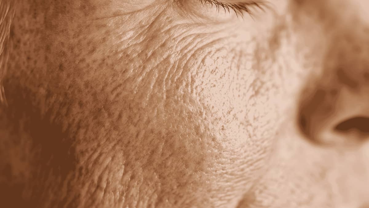 Cómo mejorar la piel acartonada con hidratación y cuidados