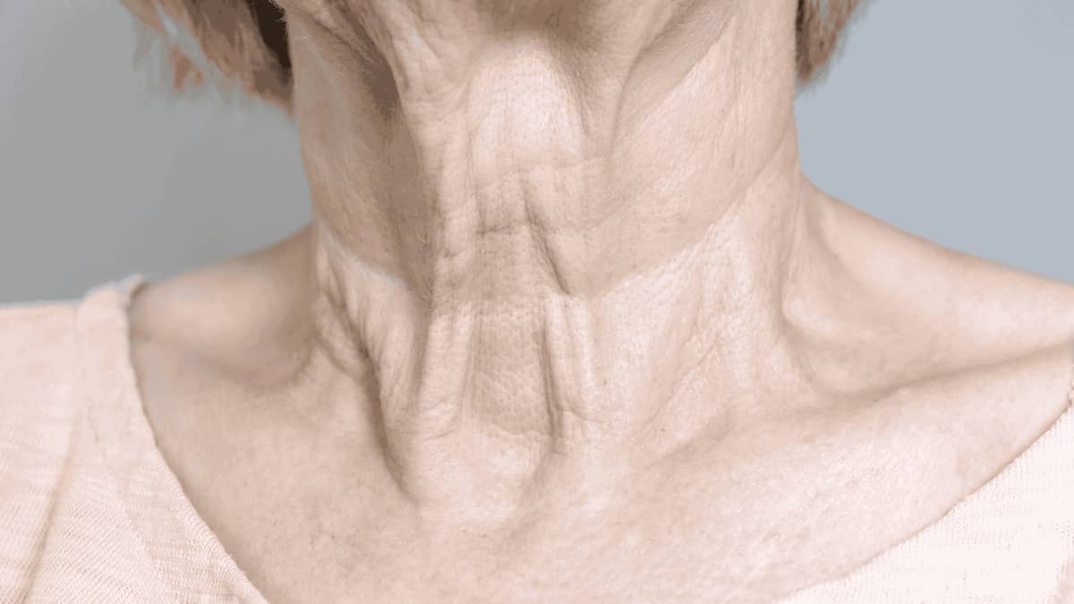 Cómo mejorar la piel arrugada de forma natural y recuperar su firmeza