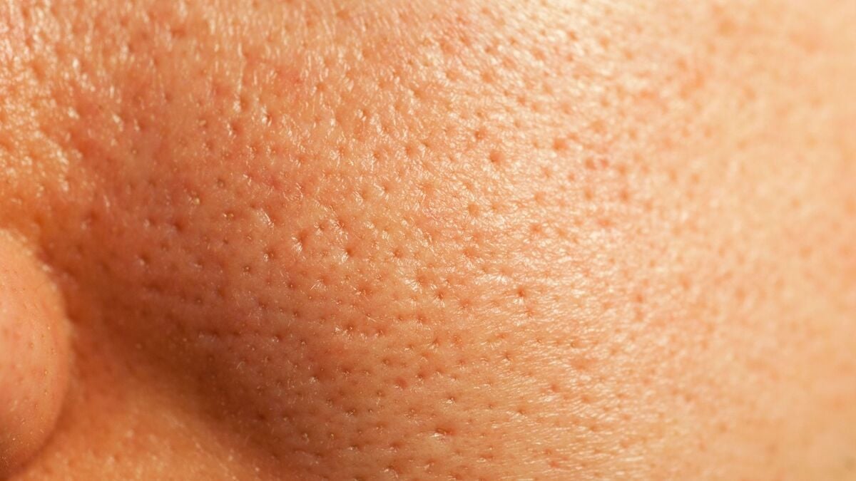 Cómo mejorar la piel porosa y reducir los poros abiertos: qué son y cómo tratarlos para tener una piel más suave, lisa y sin imperfecciones