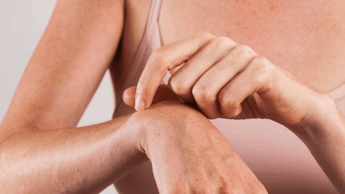 Día mundial de la dermatitis atópica: por qué la manteca de karité es perfecta para aliviar este problema