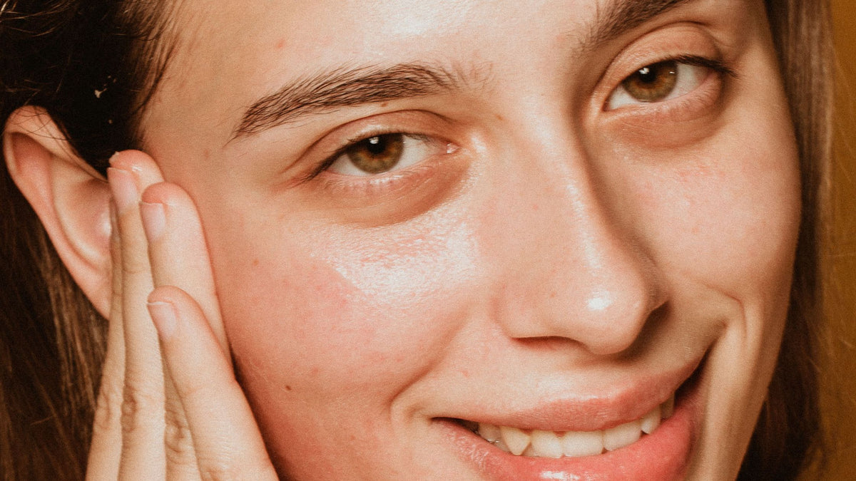 Bolsas y ojeras: todo lo que debes saber sobre ellas para evitarlas