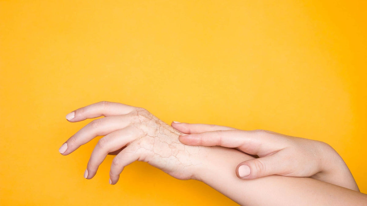 Cómo mejorar la piel seca del rostro con cuidados, causas y tratamientos efectivos