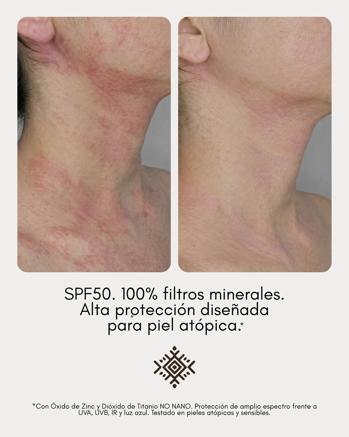 Protector Solar SPF50 Piel Atópica